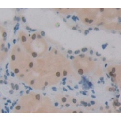 DNA Repair Protein RAD50 (RAD50) Antibody