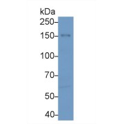 Western blot analysis of Human MCF7 cell lysate, using Human EPHA1 Antibody (2 µg/ml) and HRP-conjugated Goat Anti-Rabbit antibody (<a href="https://www.abbexa.com/index.php?route=product/search&amp;search=abx400043" target="_blank">abx400043</a>, 0.2 µg/ml).