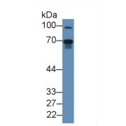 Western blot analysis of Mouse Lung lysate, using Human FGL2 Antibody (2 µg/ml) and HRP-conjugated Goat Anti-Rabbit antibody (<a href="https://www.abbexa.com/index.php?route=product/search&amp;search=abx400043" target="_blank">abx400043</a>, 0.2 µg/ml).