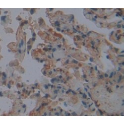 Fibrinogen Like Protein 2 (FGL2) Antibody