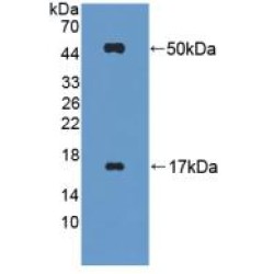 Fibrinogen Like Protein 2 (FGL2) Antibody