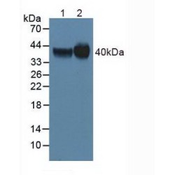 Folate Receptor Alpha (FOLR1) Antibody