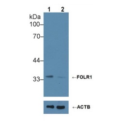 Folate Receptor Alpha (FOLR1) Antibody