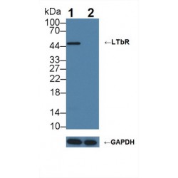 Lymphotoxin Beta Receptor (LTbR) Antibody