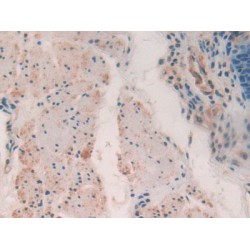 Myosin Light Chain Kinase (MYLK) Antibody