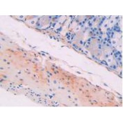 Myosin Light Chain Kinase (MYLK) Antibody