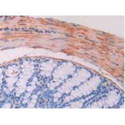 Myosin Light Chain Kinase (MYLK) Antibody