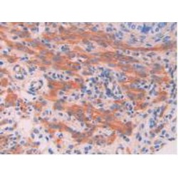 Myosin Light Chain Kinase (MYLK) Antibody