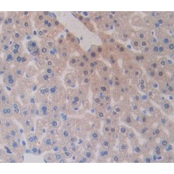 Pre-B-Lymphocyte Gene 1 (VPREB1) Antibody