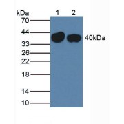 abx102581