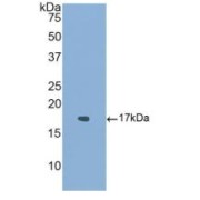 Western blot analysis of recombinant Human ACVR1.