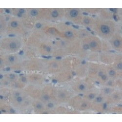 Alanine Aminotransferase 2 / ALT (GPT2) Antibody