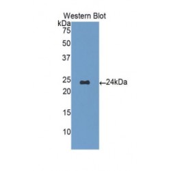 Alpha-1-Acid Glycoprotein (a1AGP) Antibody
