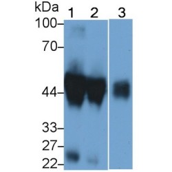 Alpha-1-Acid Glycoprotein (a1AGP) Antibody