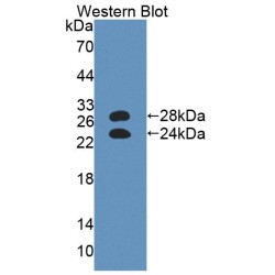 Alpha-1-Acid Glycoprotein (a1AGP) Antibody