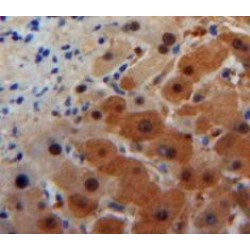 Alpha-1-Acid Glycoprotein (a1AGP) Antibody