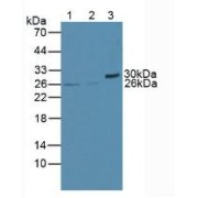 abx102594