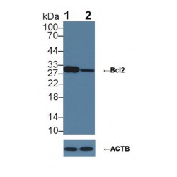 Apoptosis Regulator Bcl-2 (BCL2) Antibody