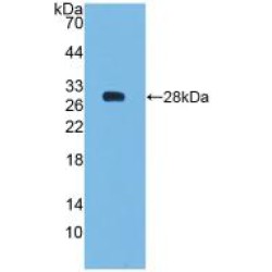 Apoptosis Regulator Bcl-2 (BCL2) Antibody