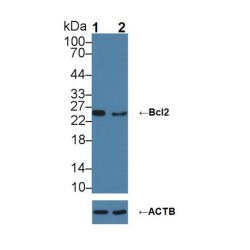 Apoptosis Regulator Bcl-2 (BCL2) Antibody