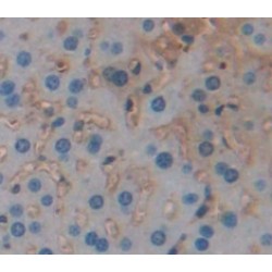 Apoptosis Regulator Bcl-2 (BCL2) Antibody