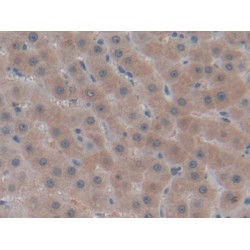 Collagen Type IV Alpha 1 (COL4A1) Antibody