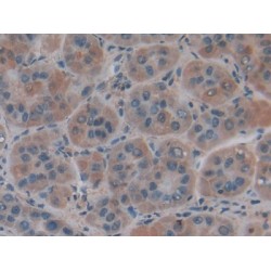 Collagen Type IV Alpha 1 (COL4A1) Antibody