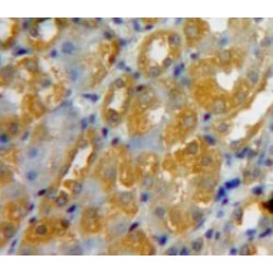 Collagen Type IV Alpha 2 (COL4A2) Antibody