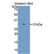 Western blot analysis of recombinant Human COL4a5 Protein.