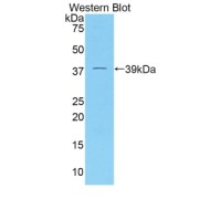 Western blot analysis of the recombinant protein.