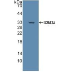 Dihydrolipoyl Dehydrogenase (DLD) Antibody