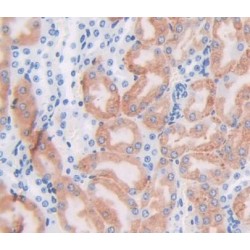 Ferritin, Heavy Polypeptide (FTH) Antibody