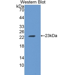 Ferritin Heavy Chain (FTH1) Antibody