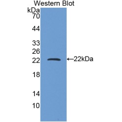 Ferritin Heavy Chain (FTH1) Antibody