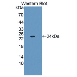 Ferritin, Light Polypeptide (FTL) Antibody