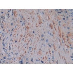Ferritin, Light Polypeptide (FTL) Antibody