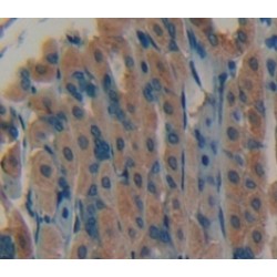 Fibroblast Growth Factor 7 (FGF7) Antibody