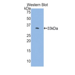 FK506 Binding Protein 10 (FKBP10) Antibody