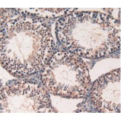 FK506 Binding Protein 10 (FKBP10) Antibody