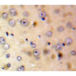 FK506 Binding Protein 1A (FKBP1A) Antibody