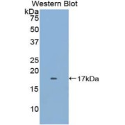 Western blot analysis of the recombinant protein.