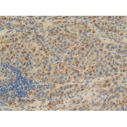 FK506 Binding Protein 1B (FKBP1B) Antibody