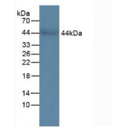 Chitinase-3-Like Protein 1 (CHI3L1) Antibody