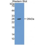 Western blot analysis of the recombinant Human CHI3L1 Protein.