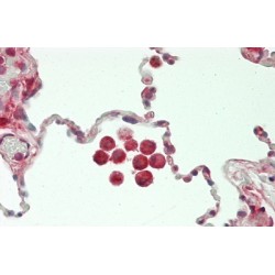 Chitinase-3-Like Protein 1 (CHI3L1) Antibody