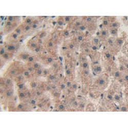 Chitinase-3-Like Protein 1 (CHI3L1) Antibody