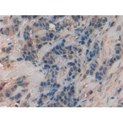 Chitinase-3-Like Protein 1 (CHI3L1) Antibody