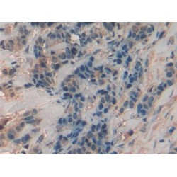 Chitinase-3-Like Protein 1 (CHI3L1) Antibody