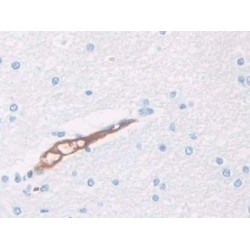 Haptoglobin Related Protein (HPR) Antibody