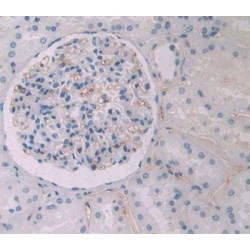 Haptoglobin Related Protein (HPR) Antibody
